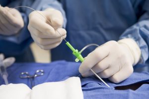 General & Plastic Surgery Medical Packaging General & Plastic Surgery Medical Packaging