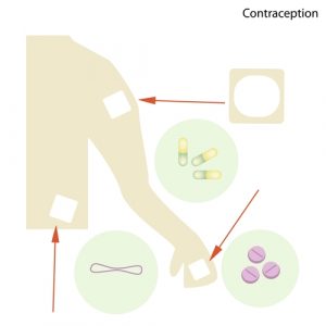 Drug Delivery Medical Packaging