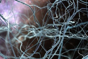 Neurology Neurology Medical Packaging